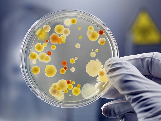 Analyse d'une boîte de Petri au laboratoire Synapse HSE